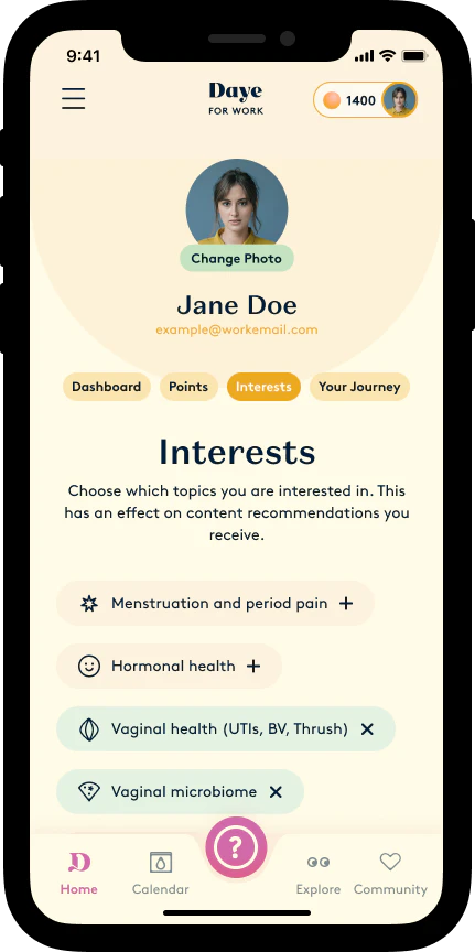 Feature customisation
