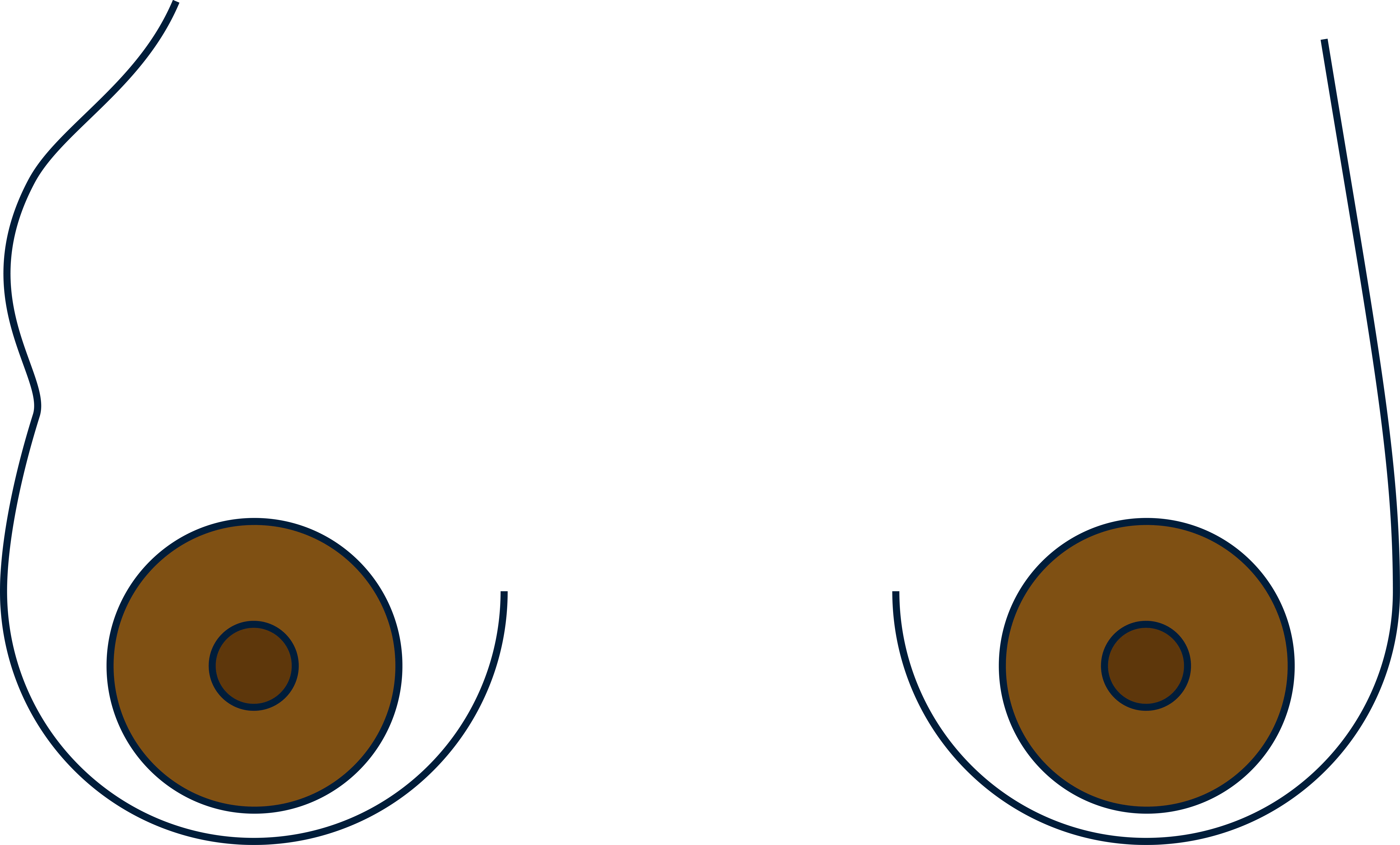 Breast swelling
