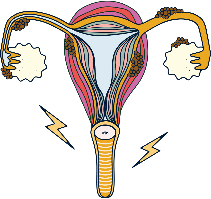 vaginal flora illustration