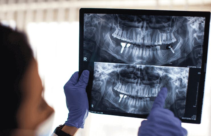 SC Training (formerly EdApp) Dental Assistant Training - Ionizing Radiation Standard