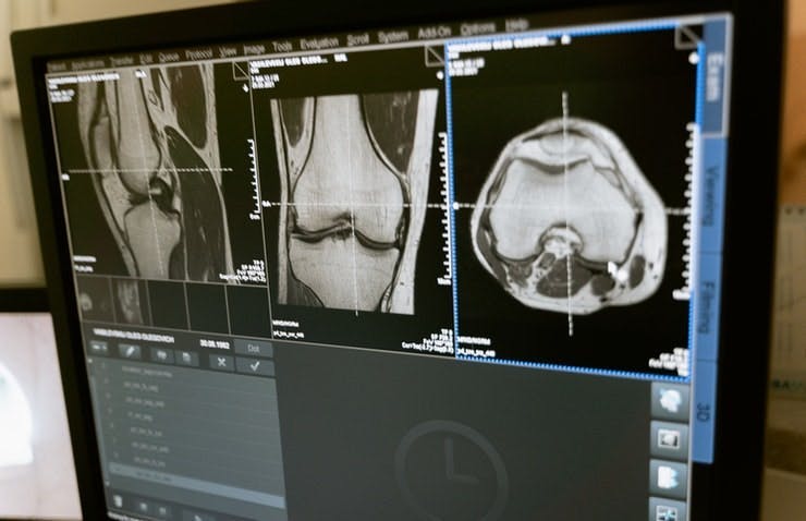 Coursera Radiation Safety Training Course - Vida, Saúde e Radiação