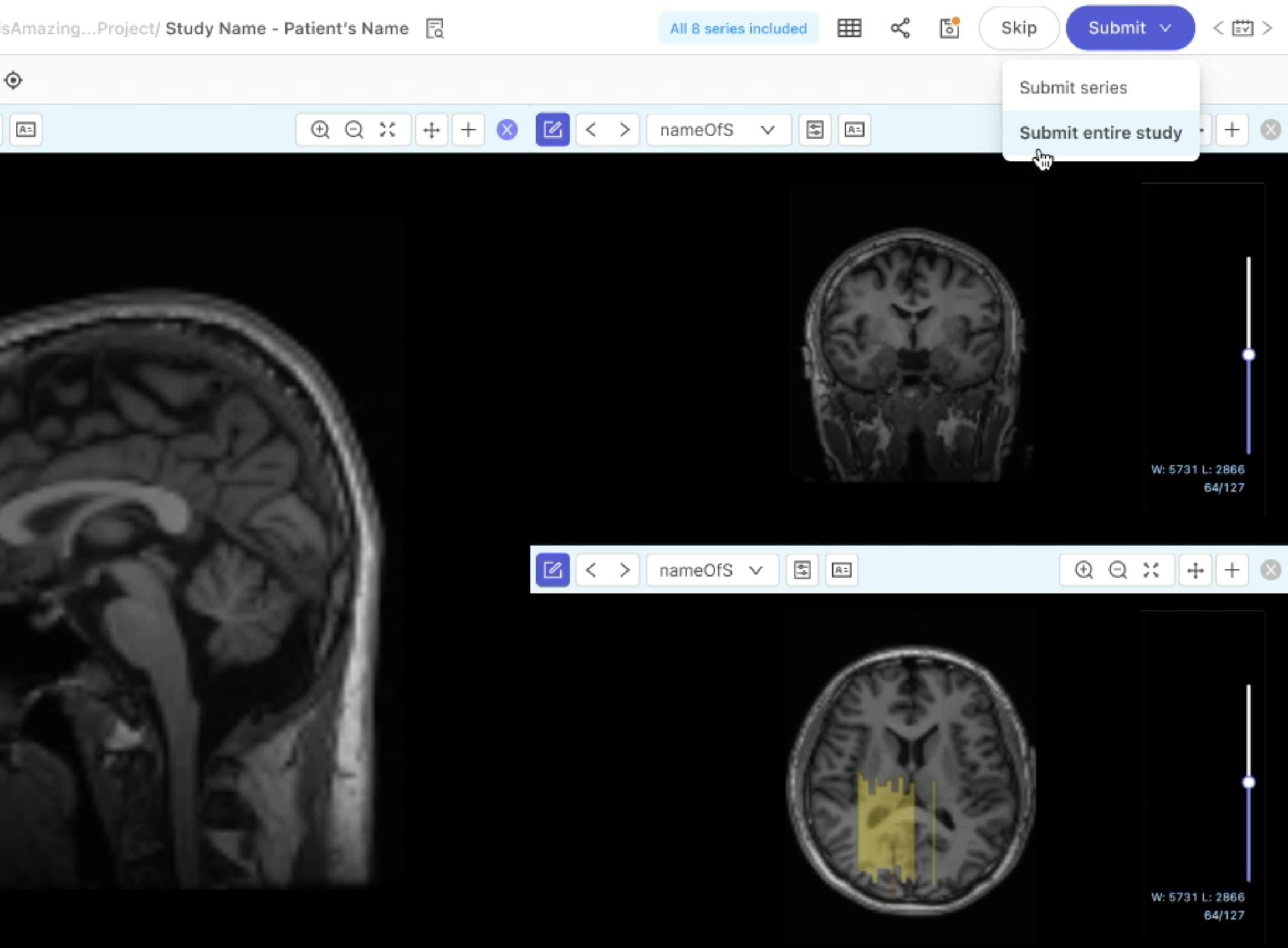 DICOM viewer image