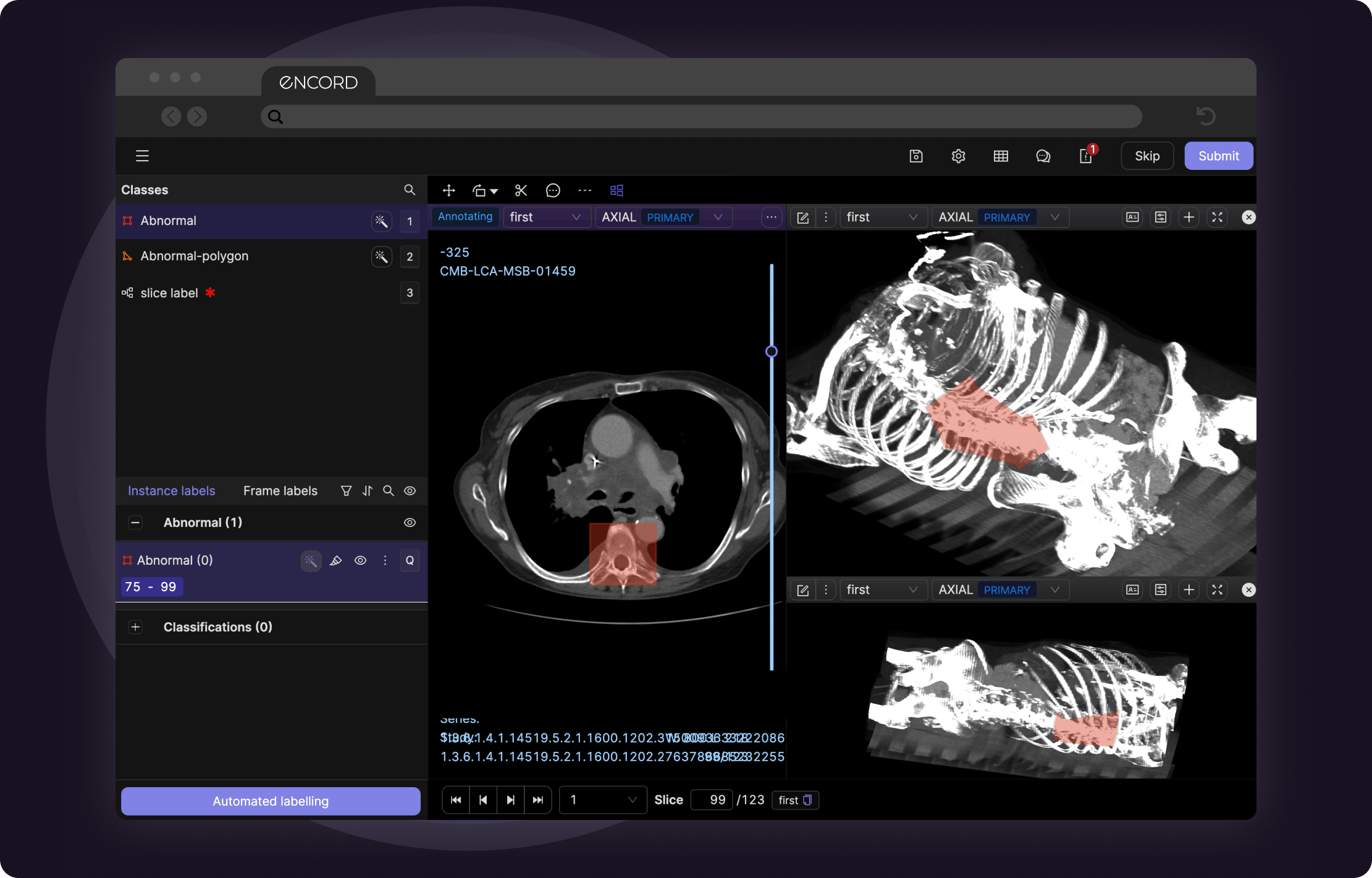 sampleImage_3d-slicer-alternatives