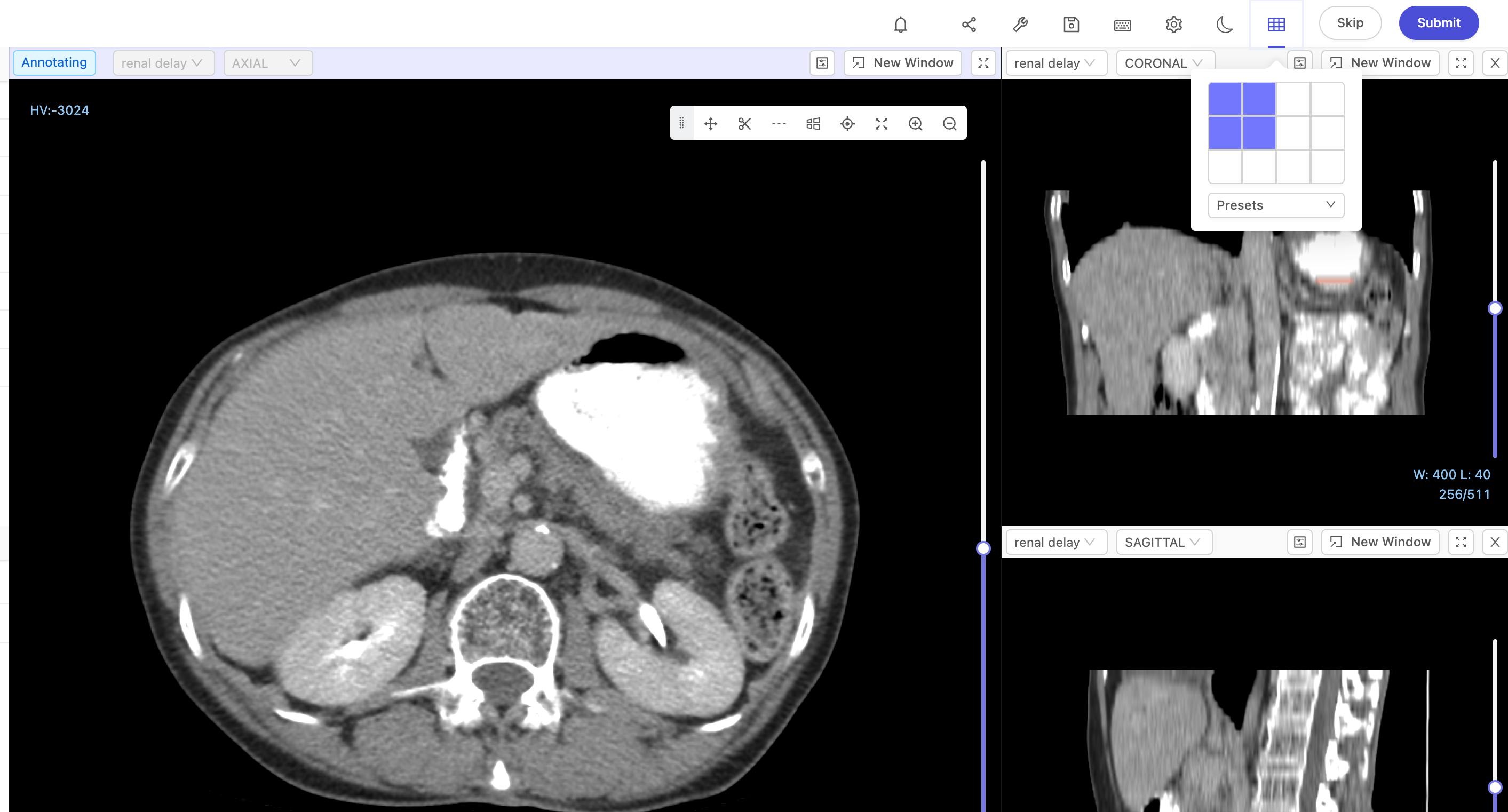 Additional support for DICOM on Encord.