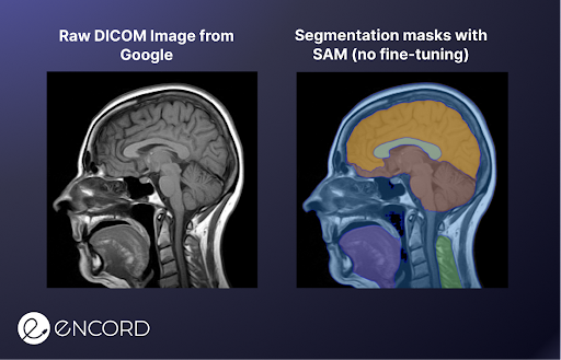 Segment Anything Model (SAM) Explained | Encord