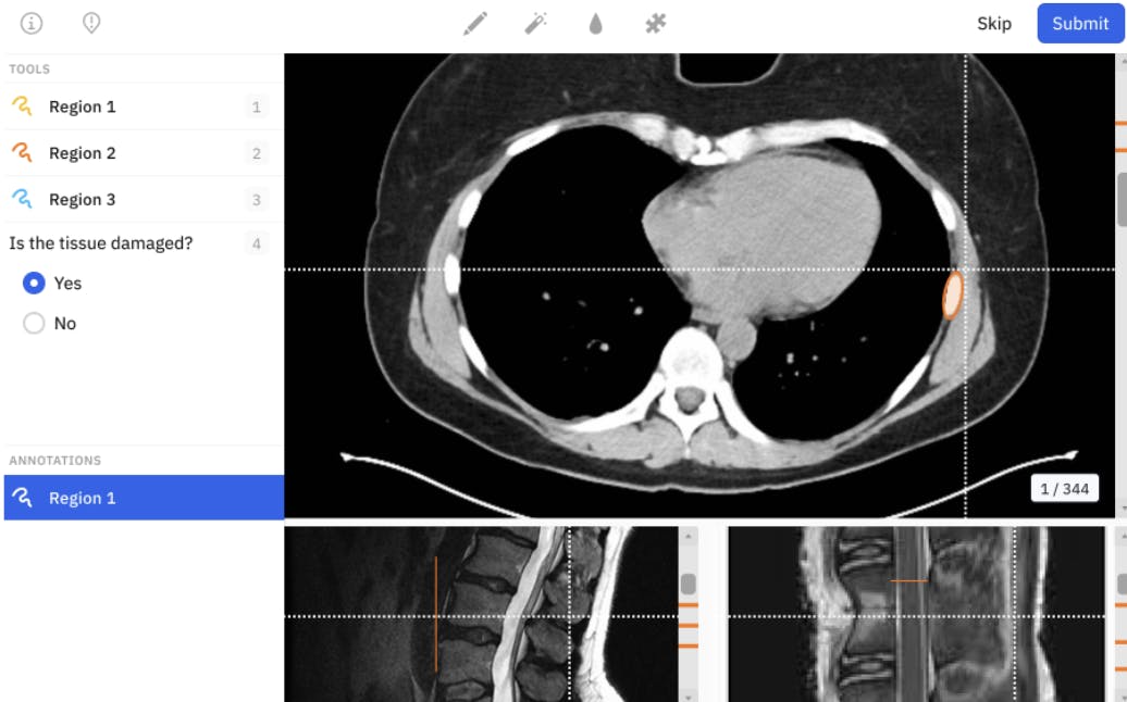 Using Labelbox to annotate DICOM images