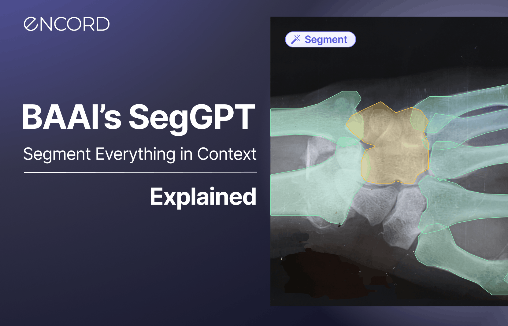 sampleImage_seggpt-segment-everything-in-context-explainer