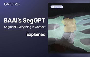 sampleImage_seggpt-segment-everything-in-context-explainer