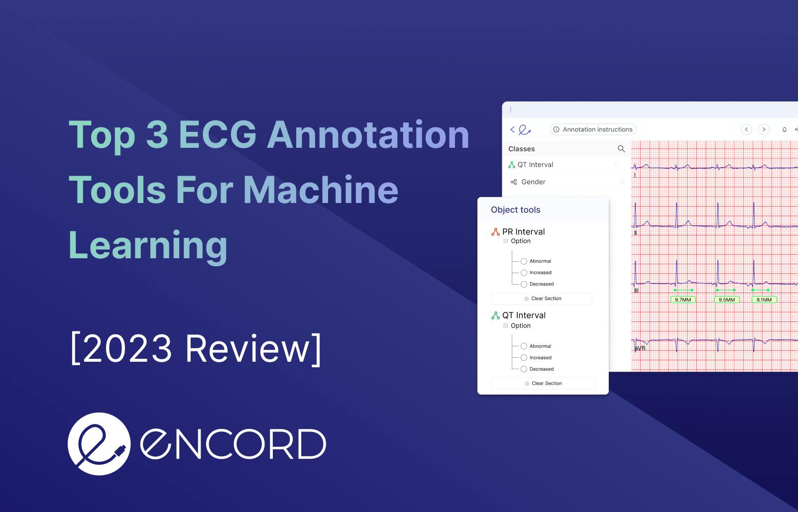 sampleImage_top-3-ecg-annotation-tools-for-machine-learning-2023