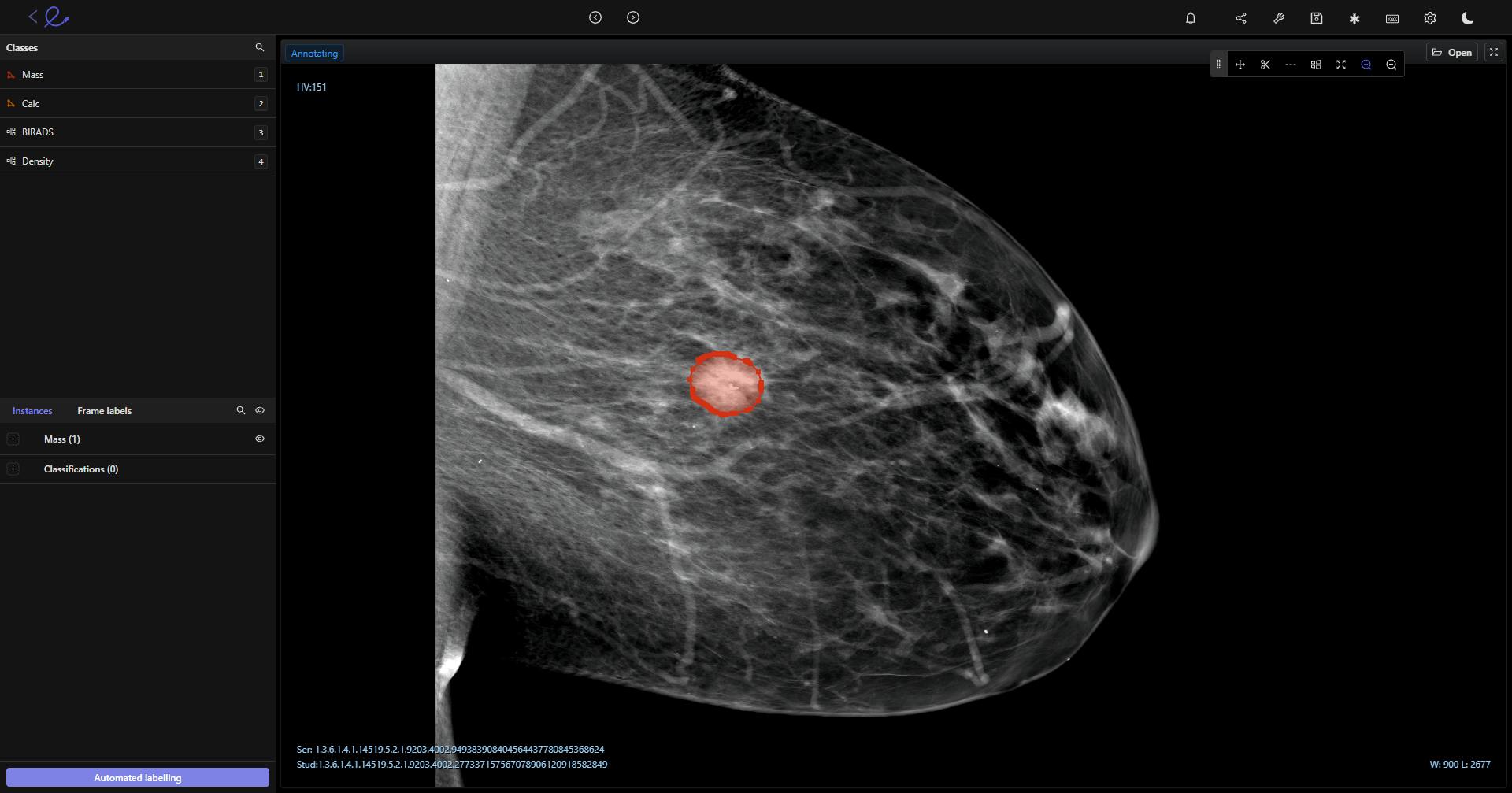 DICOM annotation in Encord