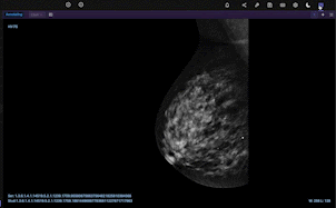Mammogram GIF in Encord DICOM viewer