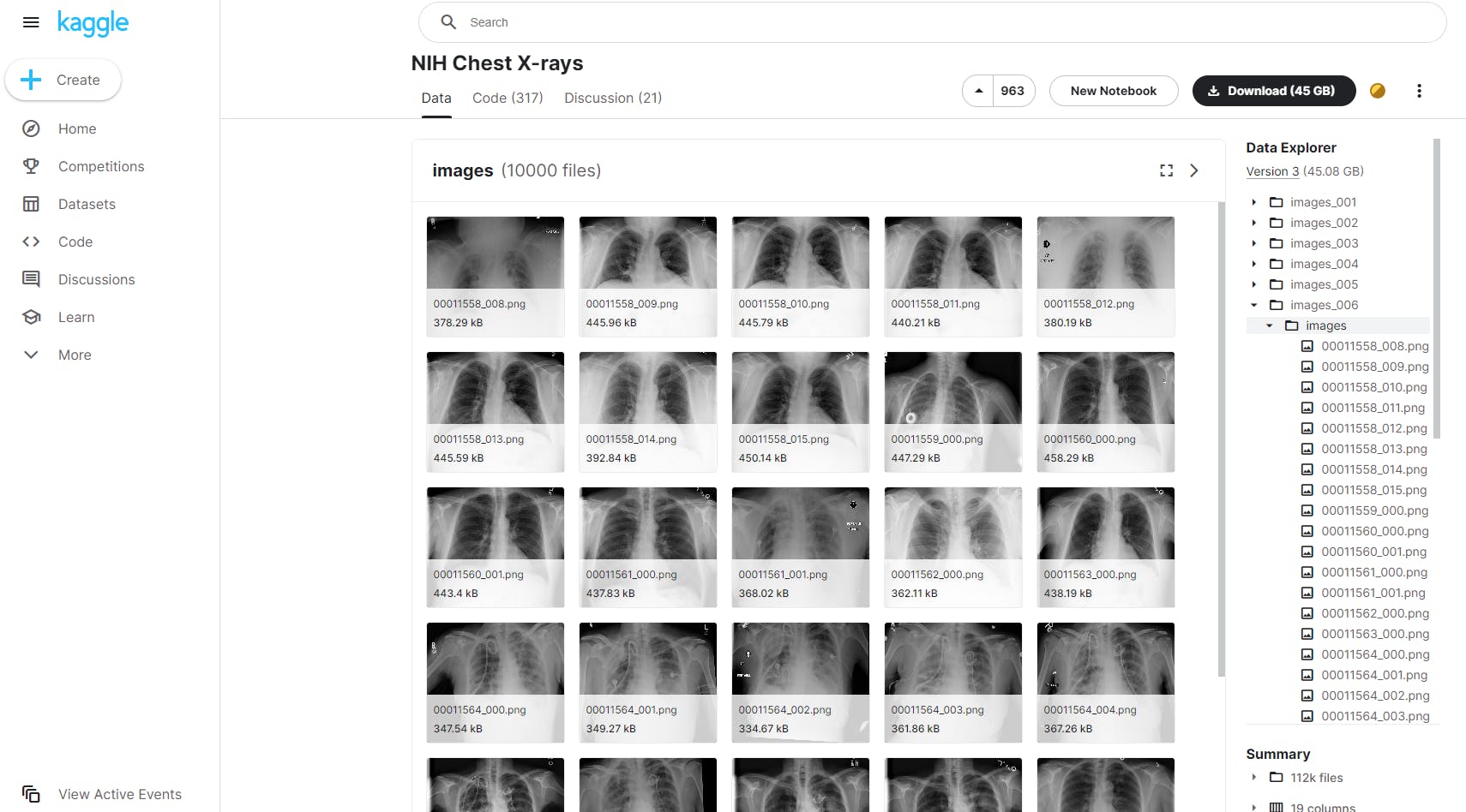 Examples from the NIH chest X-rays dataset.