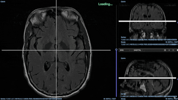 sampleImage_dicom-updates-march-2023