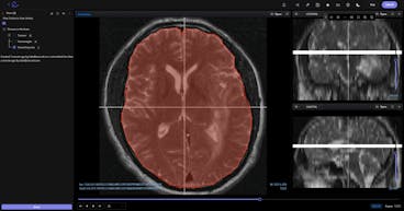 sampleImage_dicom-and-nifti-files-annotation-guide