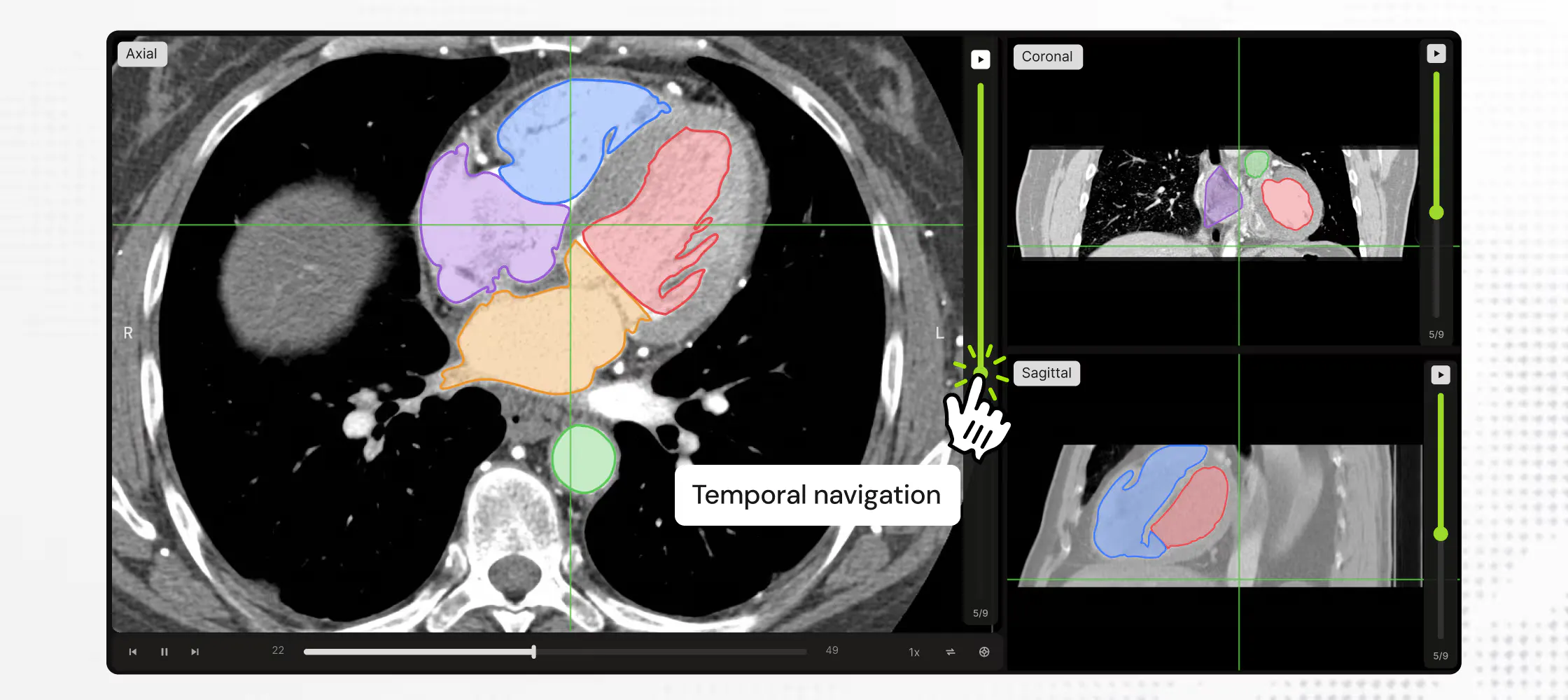Find, read and label medical scans faster
