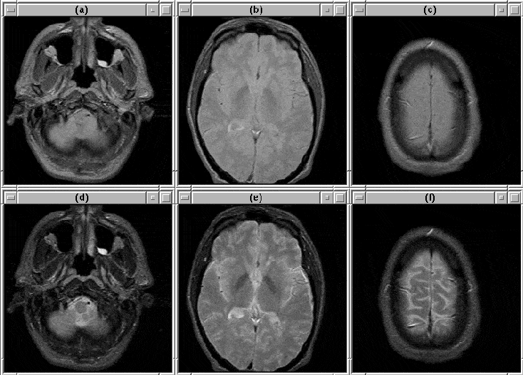 MRI data 