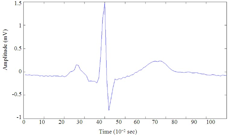 ECG annotation data 