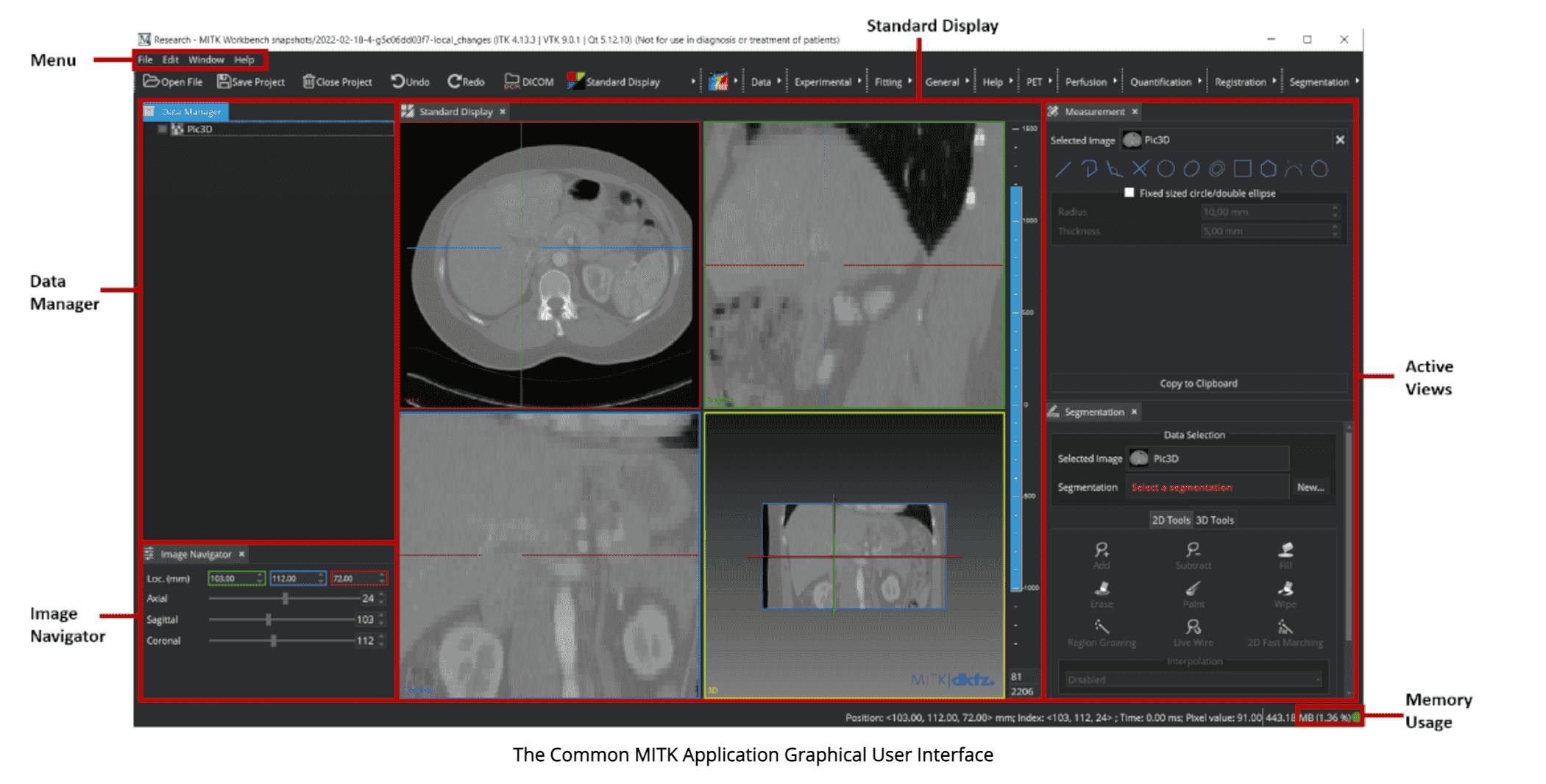 MTIK DICOM image annotator