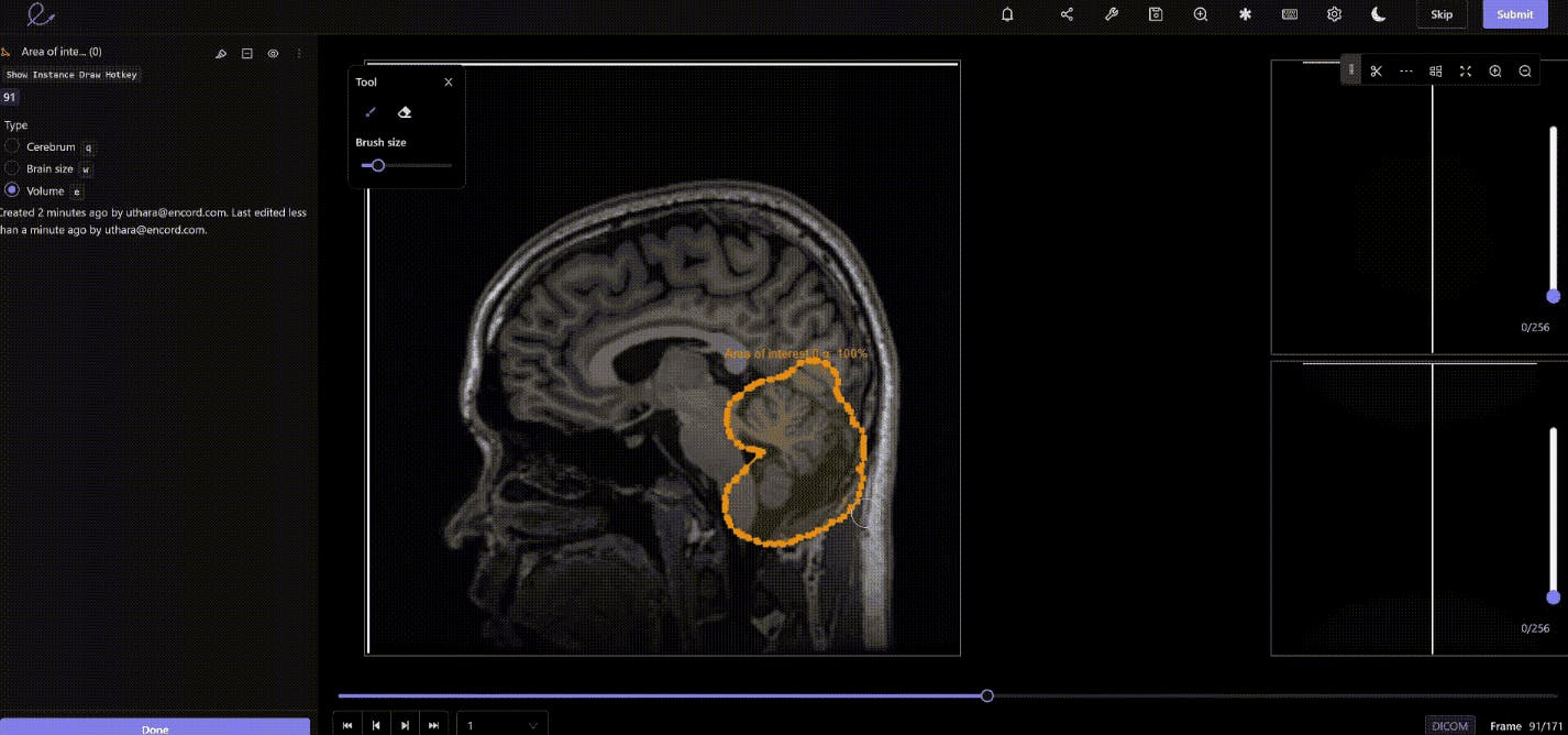 Polygon annotation of brain in Encord platform