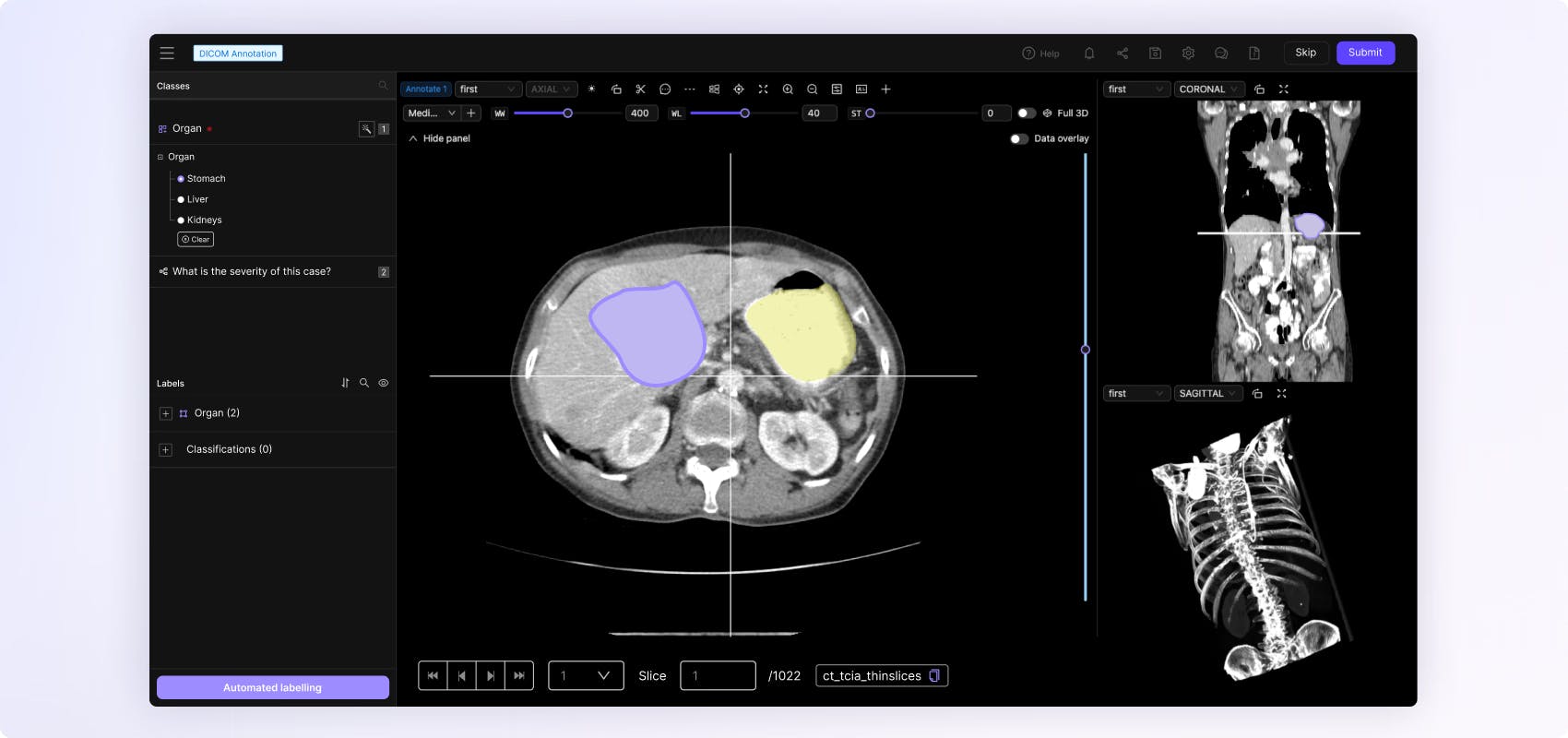 DICOM & NifTI annotation