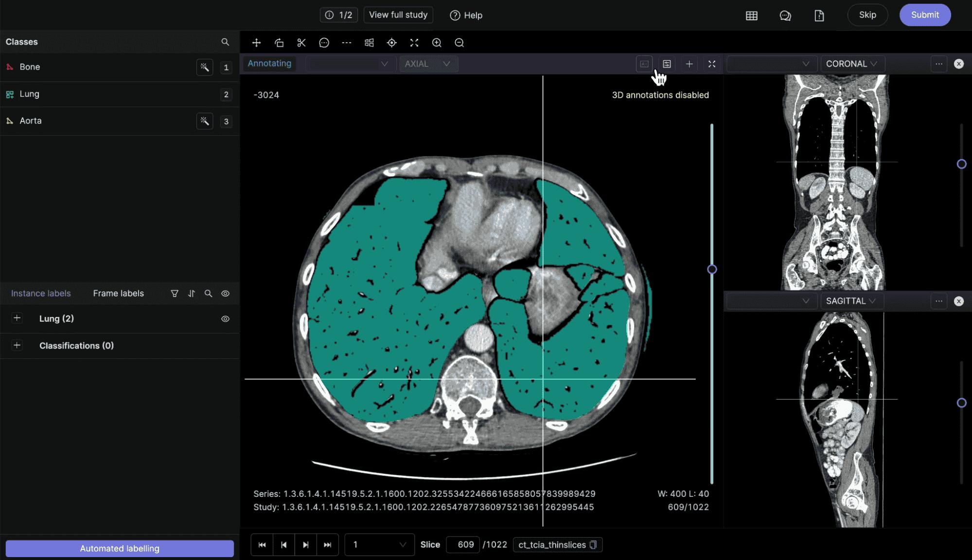 Segmentation Mask (Bitmask) Annotation in Encord