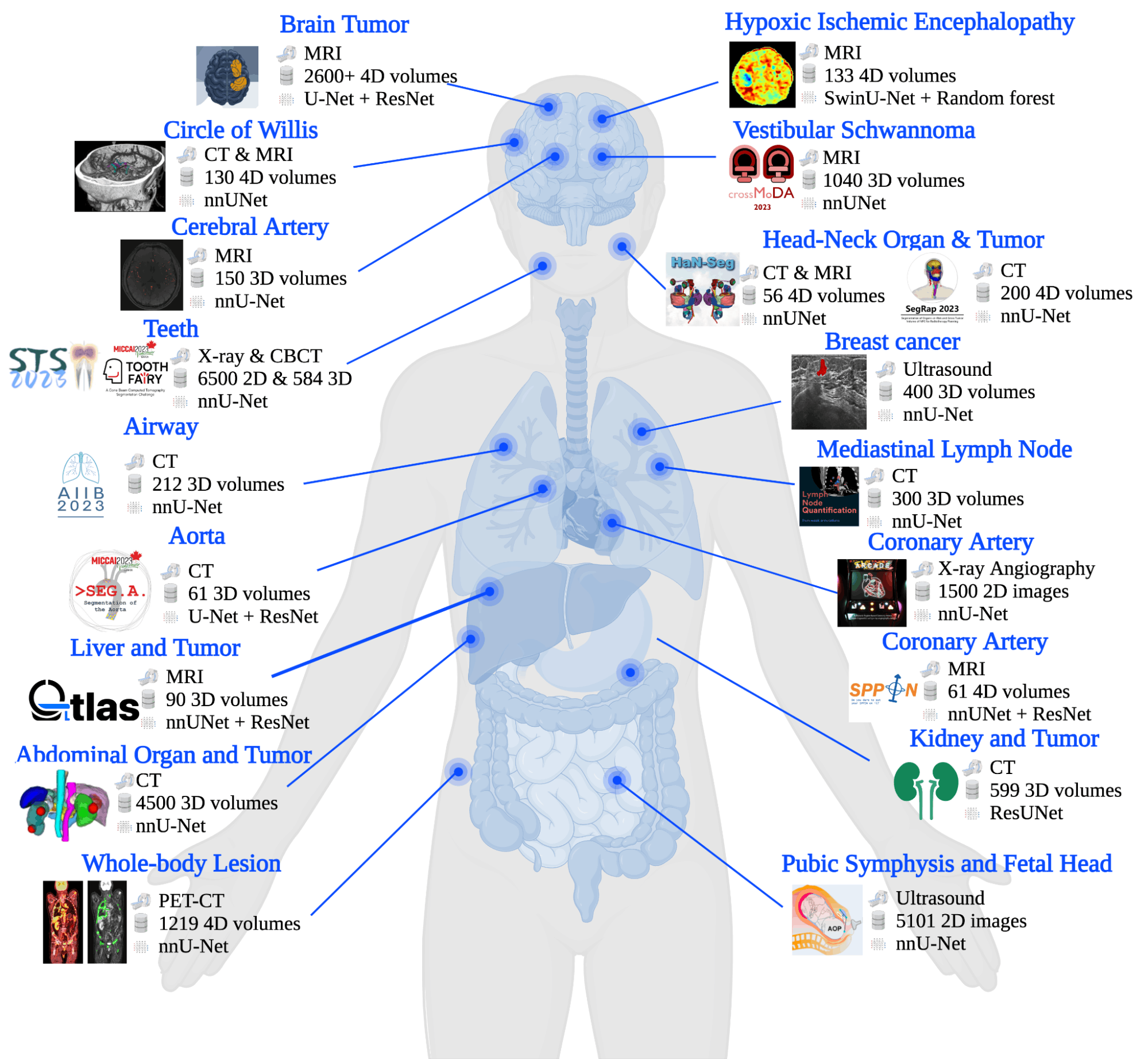 Medical Imaging Segmentation Methods
