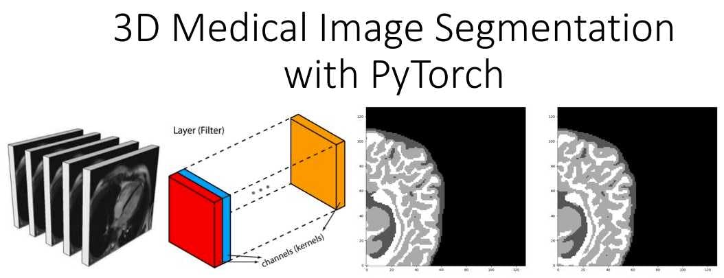 Implementing Image Segmentation in PyTorch