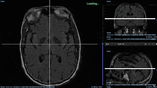 DICOM annotation of brain on Encord platform