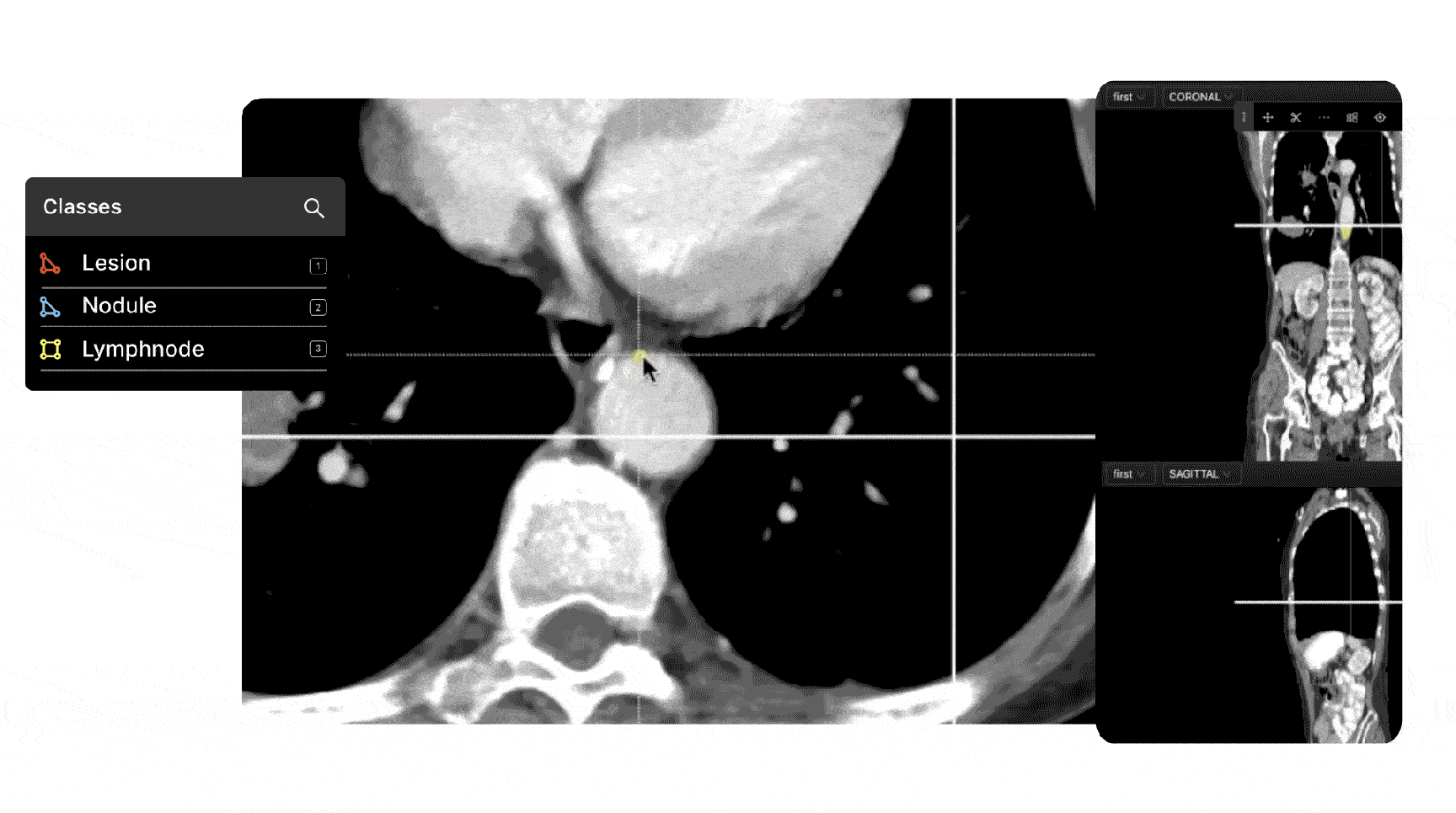 Encord being used in a medical imaging, healthcare environment