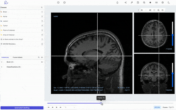 Annotated DICOM on Encord platform