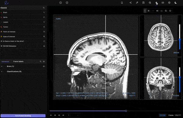 Window width and window level adjestment of annotated DICOM on Encord platform