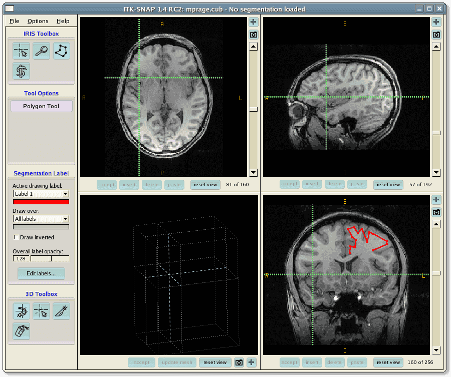 example of manual segmentation mode on ITK-Snap