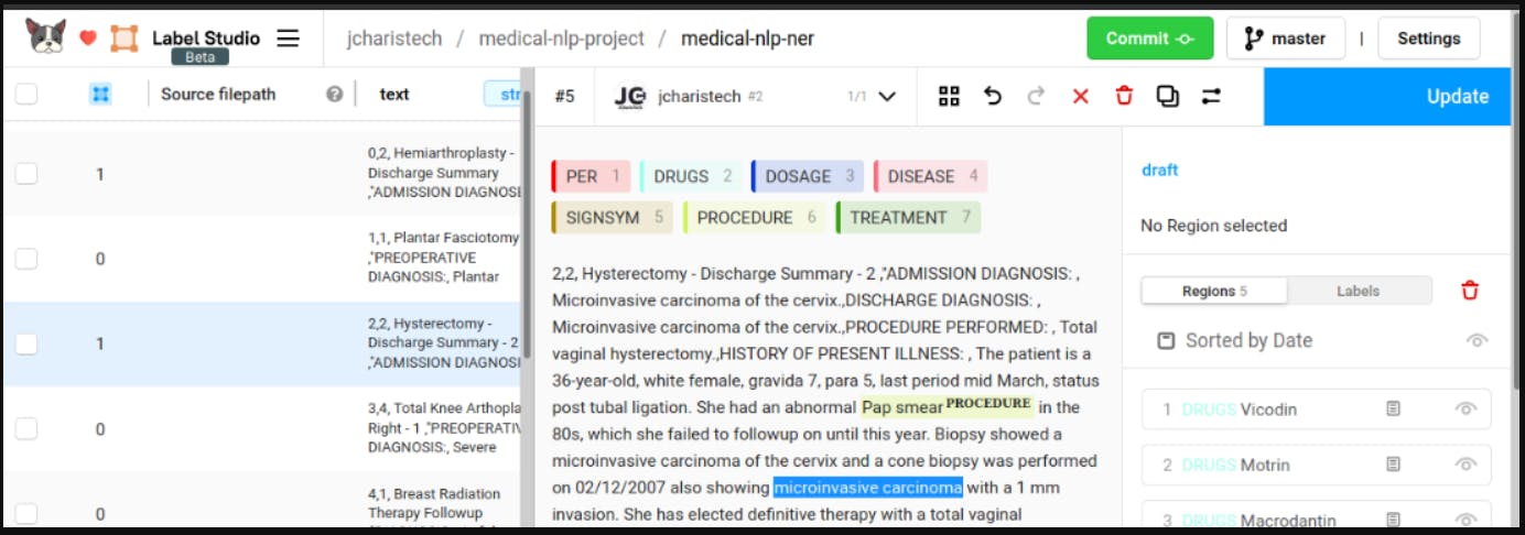 Label studio annotation platform screenshot