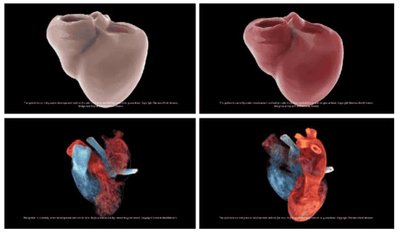 Digital Twin Visualization of the Human Heart