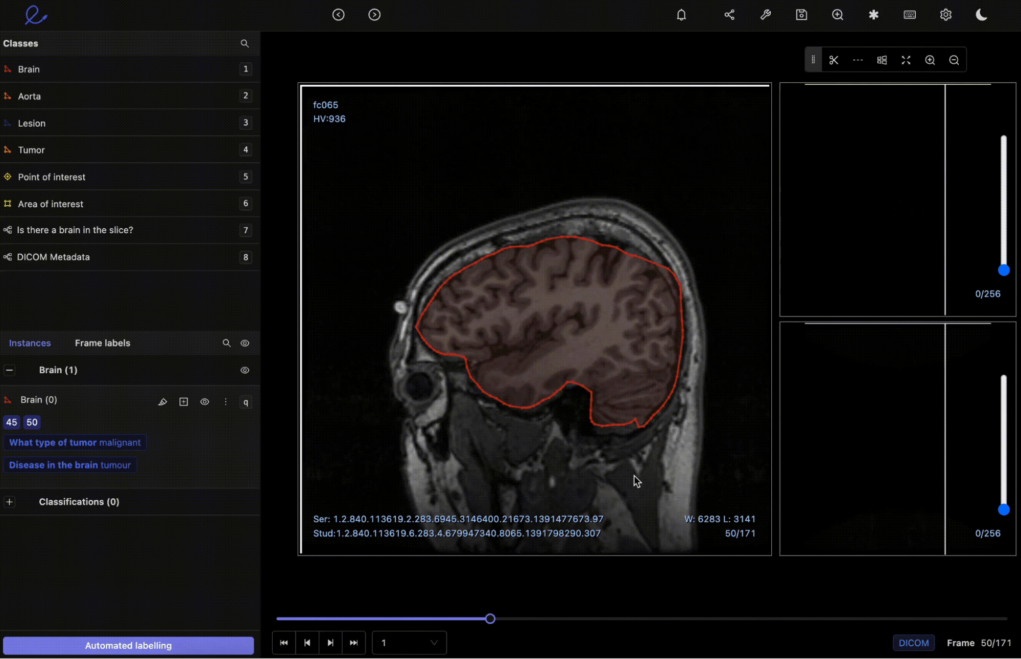 Medical Imaging within Encord Annotate's DICOM Editor