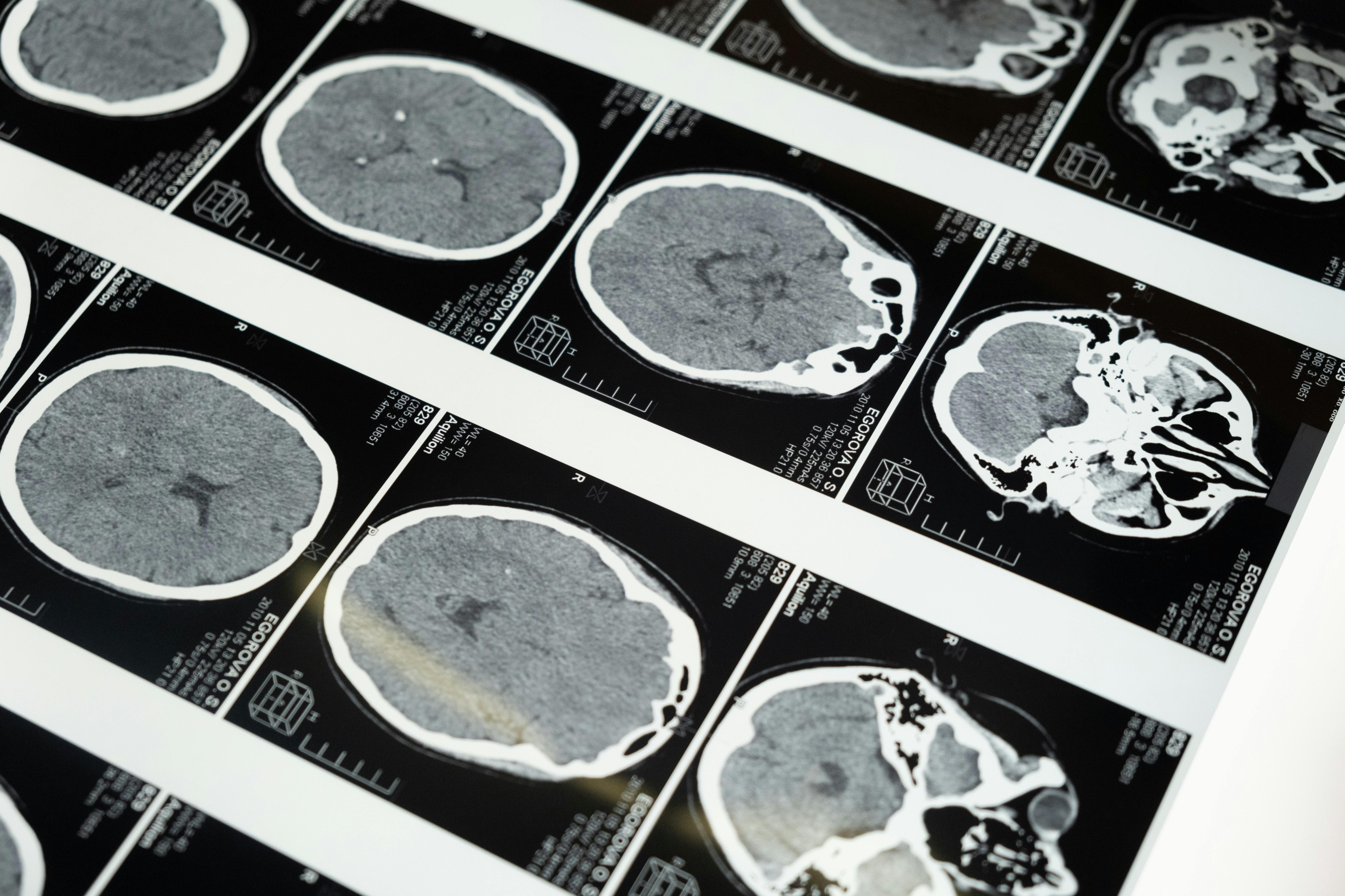sampleImage_best-open-source-annotation-medical-imaging