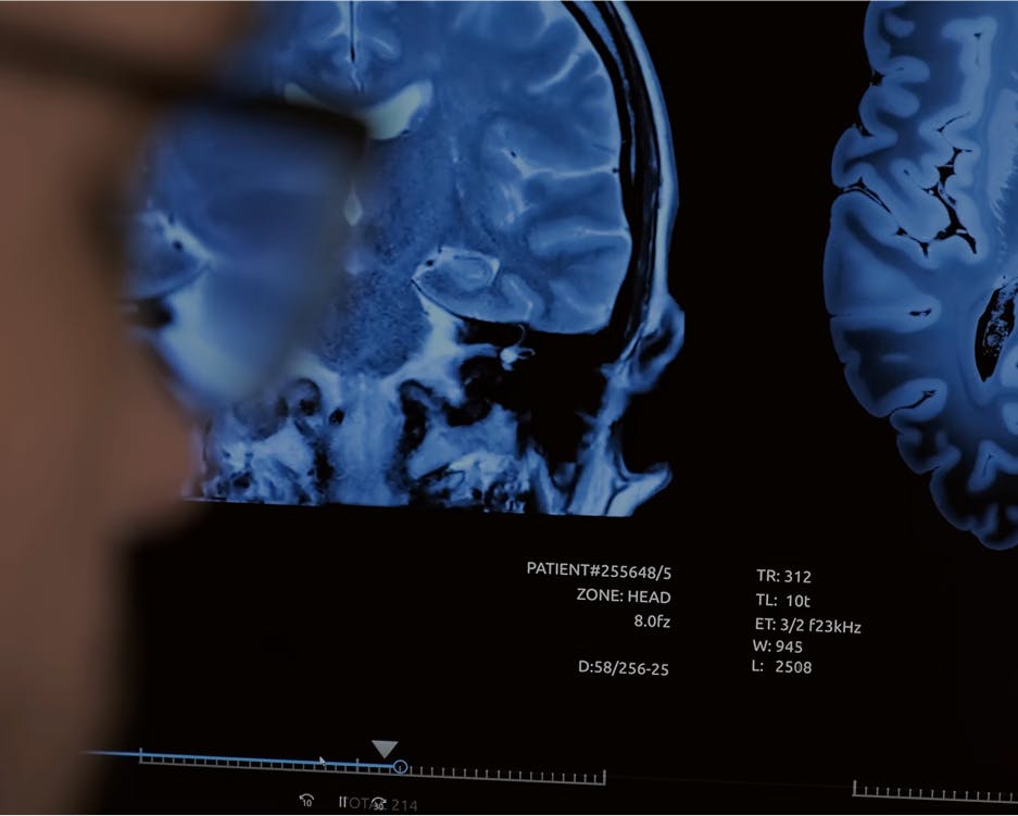 Floy Reduced CT & MRI Annotation Time with AI-Assisted Labeling