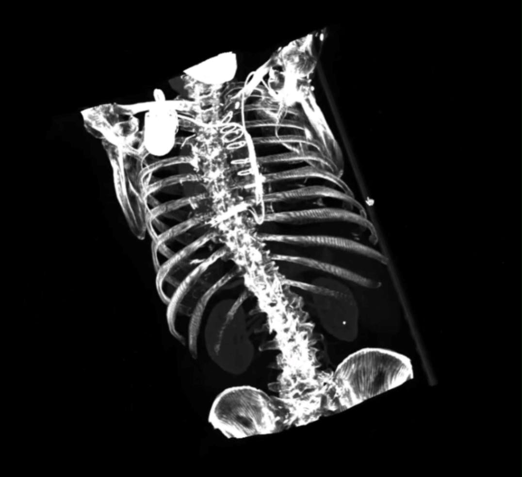 Medical Data 3D View in Encord