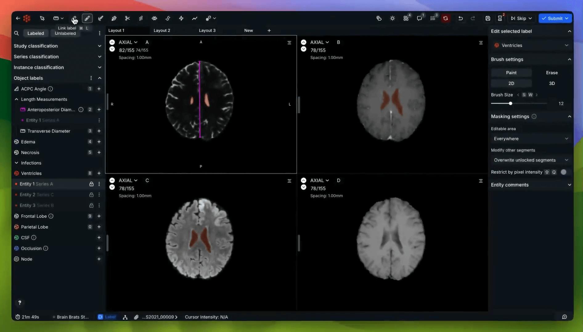 RedBrick AI Labeling