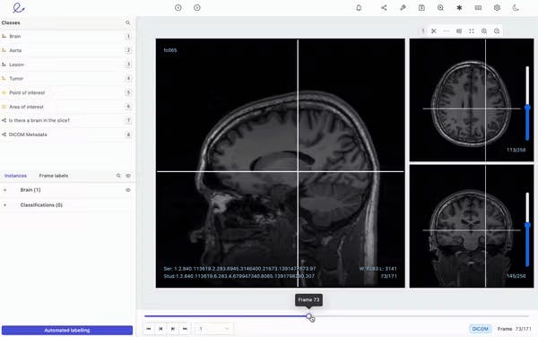 sampleImage_best-video-annotation-tools-for-healthcare