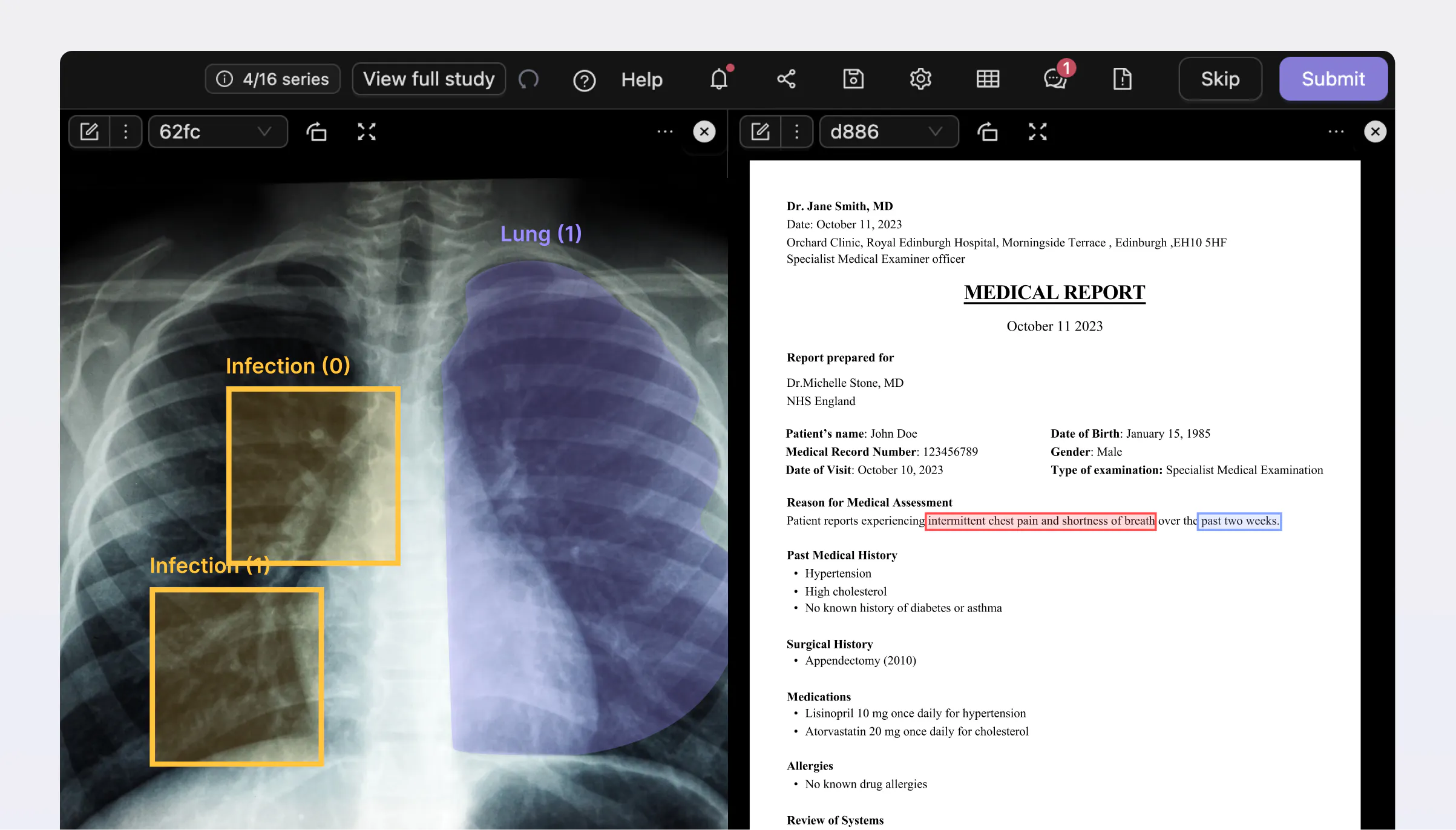 Multimodal DICOM annotation