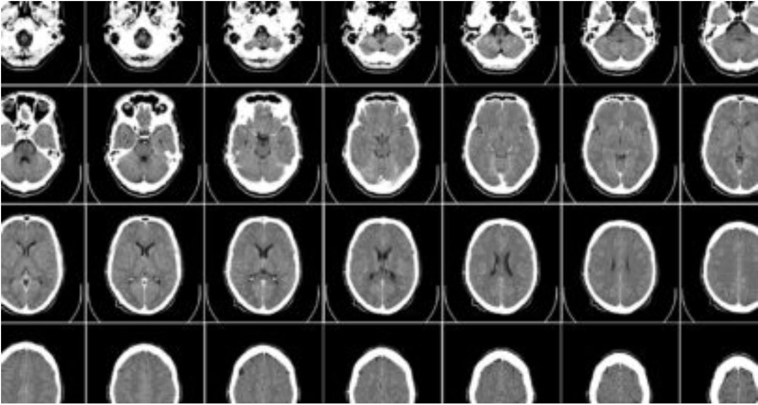 Example of open sourcesynthetic brain image.