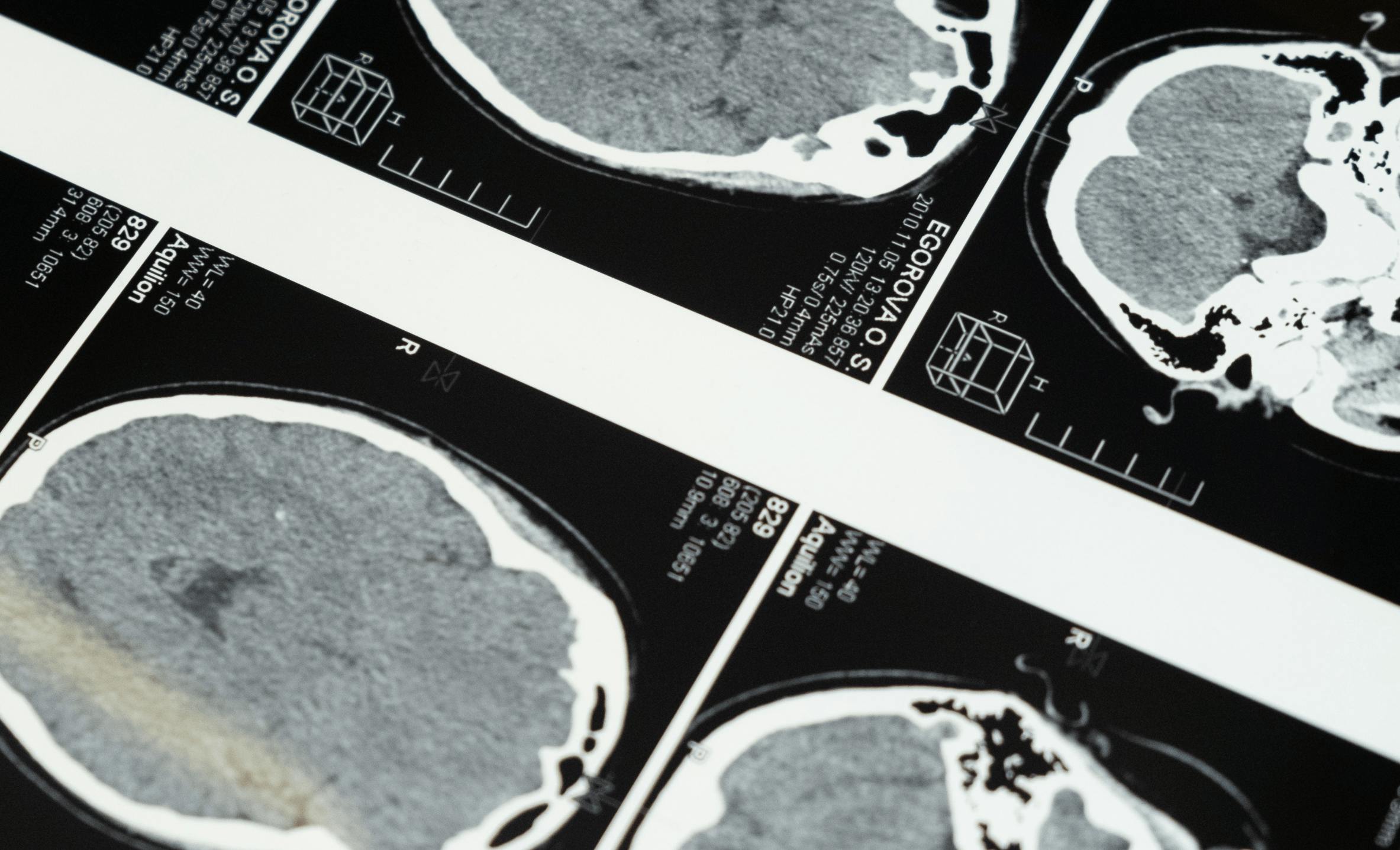 Reducing MRI and CT Annotation Time by 70% for Rapid AI