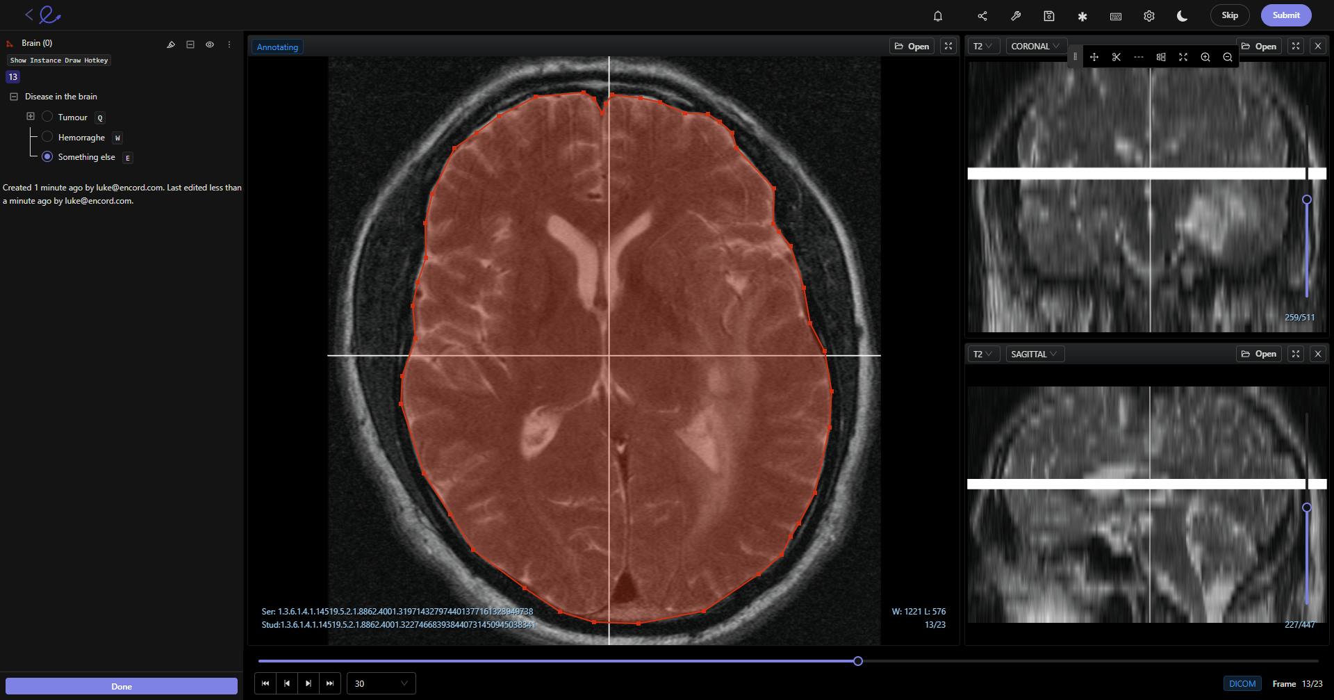 sampleImage_healthcare-computer-vision-future