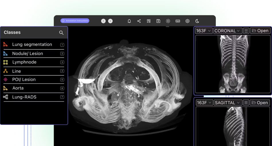 Best Open Source DICOM Annotation Tools | Encord