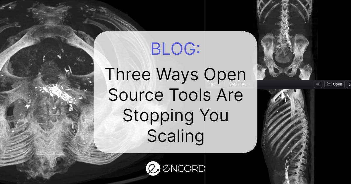 sampleImage_three-ways-open-source-tools-are-slowing-down-your-medical-imaging-model-development