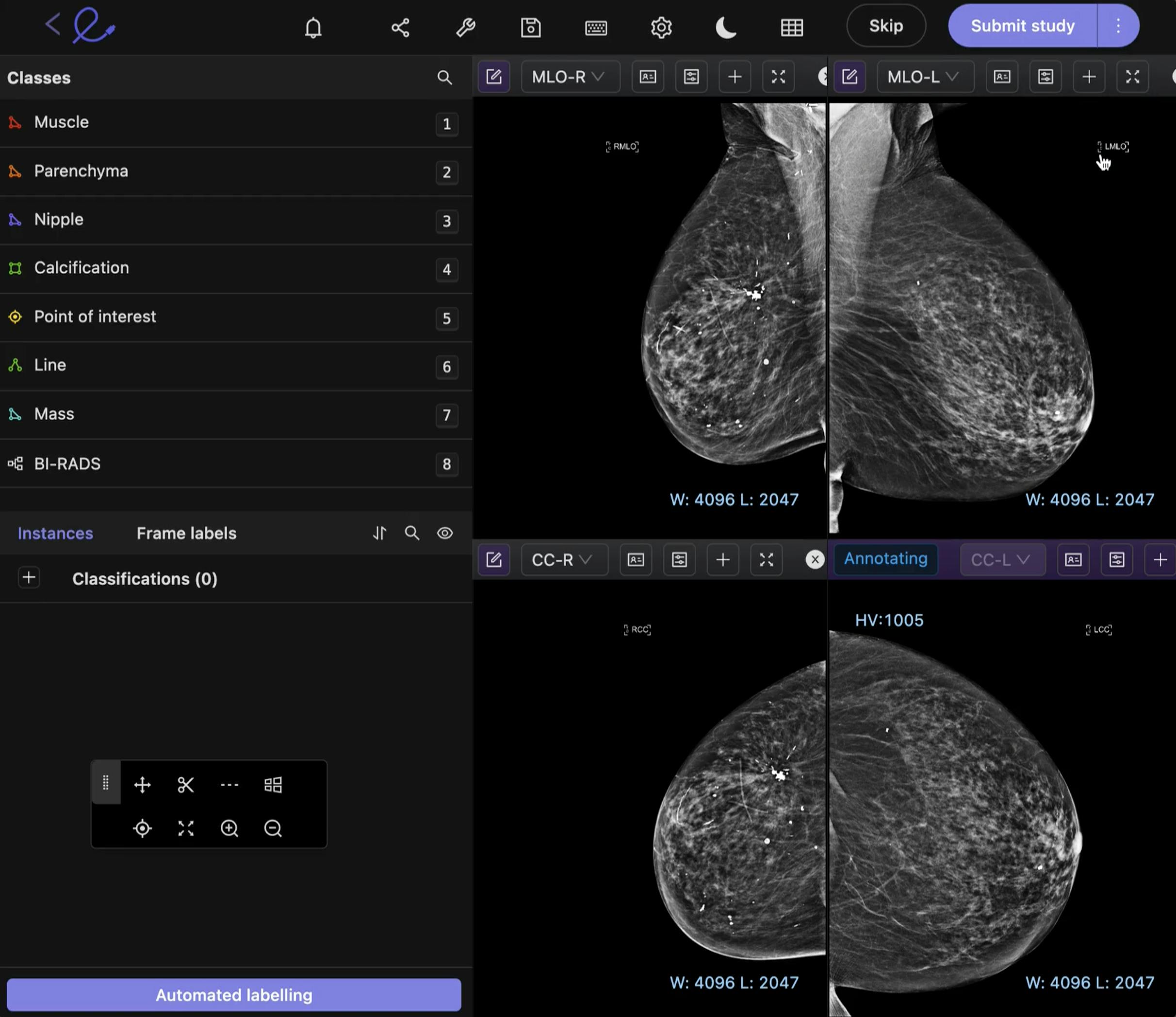 sampleImage_dicom-updates-april-2023