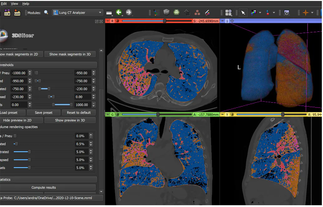 Real Life Dicom Viewer | RadiAnt DICOM Viewer下载-RadiAnt DICOM Viewer最新版 ...