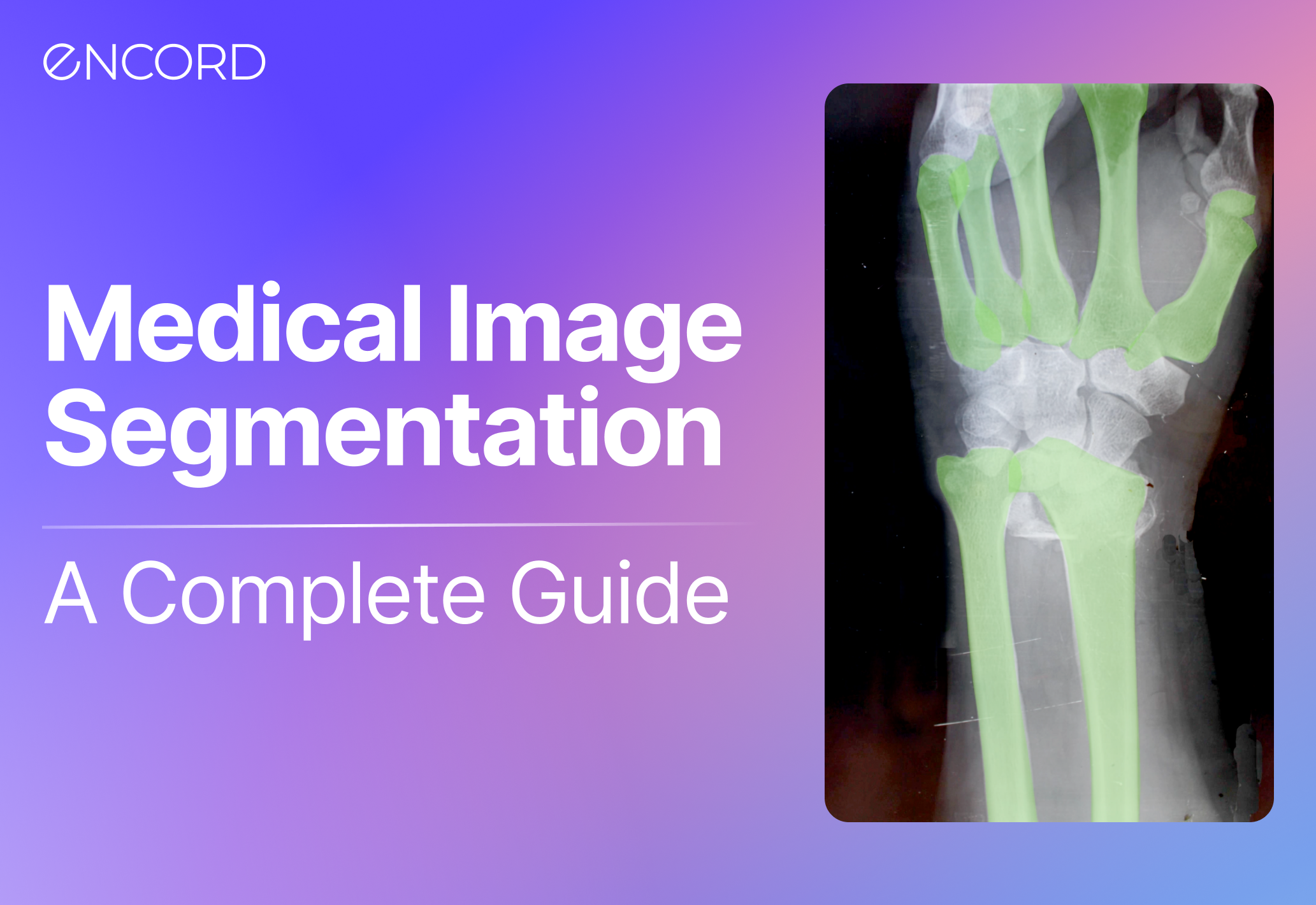 Medical Image Segmentation: A Complete Guide | Encord