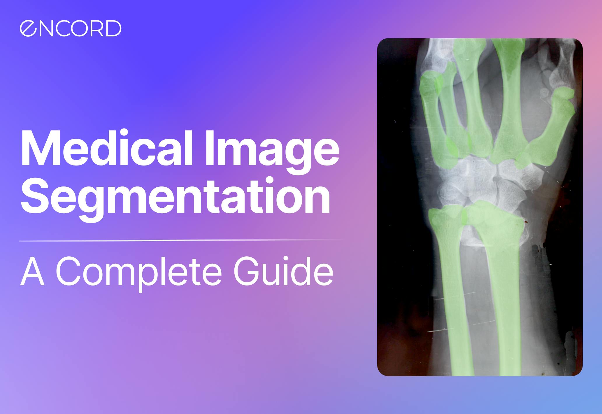 sampleImage_medical-image-segmentation